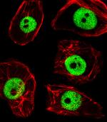 TPD52L3 Antibody in Immunocytochemistry (ICC/IF)