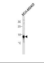 TPD52L3 Antibody in Western Blot (WB)