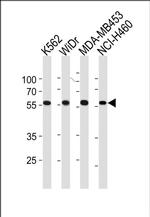 NPIPL2 Antibody in Western Blot (WB)