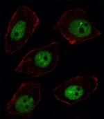 ARGBP2 Antibody in Immunocytochemistry (ICC/IF)