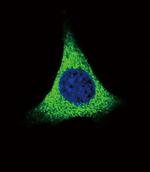 Thrombospondin 1 Antibody in Immunocytochemistry (ICC/IF)