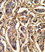 Thrombospondin 1 Antibody in Immunohistochemistry (Paraffin) (IHC (P))