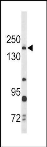 Thrombospondin 1 Antibody in Western Blot (WB)