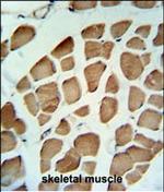 PDK2 Antibody in Immunohistochemistry (Paraffin) (IHC (P))