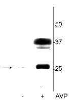 Phospho-Aquaporin 2 (Ser264) Antibody in Western Blot (WB)