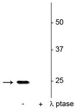 Phospho-SNAP25 (Ser187) Antibody in Western Blot (WB)