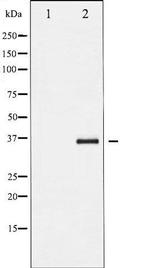 Phospho-I kappa-B-beta (Ser23) Antibody in Western Blot (WB)