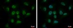 CBX6 Antibody in Immunocytochemistry (ICC/IF)