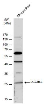 DGCR6L Antibody in Western Blot (WB)