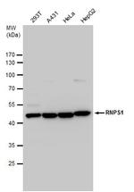 RNPS1 Antibody in Western Blot (WB)