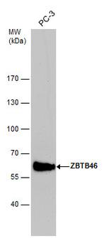 ZBTB46 Antibody in Western Blot (WB)