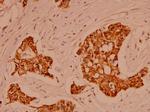 alpha Catenin Antibody in Immunohistochemistry (Paraffin) (IHC (P))