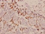 LIMK1/LIMK2 Antibody in Immunohistochemistry (Paraffin) (IHC (P))