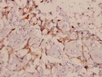 LIMK1/LIMK2 Antibody in Immunohistochemistry (Paraffin) (IHC (P))