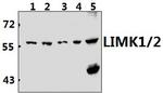 LIMK1/LIMK2 Antibody in Western Blot (WB)