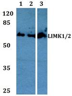 LIMK1/LIMK2 Antibody in Western Blot (WB)