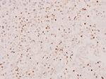 STAT5 alpha/beta Antibody in Immunohistochemistry (Paraffin) (IHC (P))