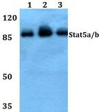 STAT5 alpha/beta Antibody in Western Blot (WB)