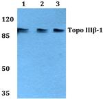 TOP3B Antibody in Western Blot (WB)