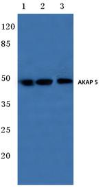 AKAP5 Antibody in Western Blot (WB)