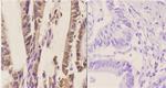 SS18 Antibody in Immunohistochemistry (Paraffin) (IHC (P))