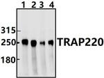 TRAP220 Antibody in Western Blot (WB)