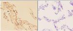 alpha Actinin 3 Antibody in Immunohistochemistry (Paraffin) (IHC (P))