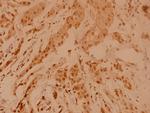 NPM1 Antibody in Immunohistochemistry (Paraffin) (IHC (P))