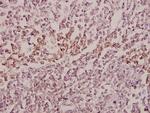 MID1 Antibody in Immunohistochemistry (Paraffin) (IHC (P))