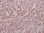 MID1 Antibody in Immunohistochemistry (Paraffin) (IHC (P))