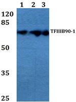 BRF1 Antibody in Western Blot (WB)