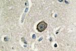 CDH8 Antibody in Immunohistochemistry (Paraffin) (IHC (P))