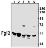 FGL2 Antibody in Western Blot (WB)