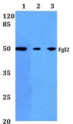 FGL2 Antibody in Western Blot (WB)