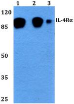 IL4R Antibody in Western Blot (WB)