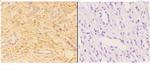 ACOT2 Antibody in Immunohistochemistry (Paraffin) (IHC (P))