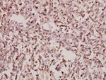 Arfaptin 1 Antibody in Immunohistochemistry (Paraffin) (IHC (P))