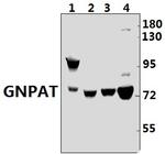 GNPAT Antibody in Western Blot (WB)