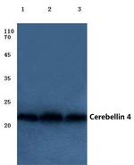 Cerebellin 4 Antibody in Western Blot (WB)