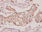 CYB5R3 Antibody in Immunohistochemistry (Paraffin) (IHC (P))