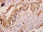 ME3 Antibody in Immunohistochemistry (Paraffin) (IHC (P))