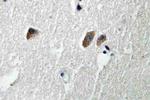 CaMKII beta/gamma/delta Antibody in Immunohistochemistry (Paraffin) (IHC (P))