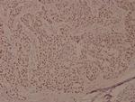 Phospho-BRCA1 (Ser1524) Antibody in Immunohistochemistry (Paraffin) (IHC (P))