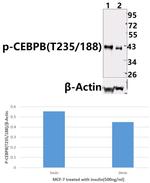 Phospho-C/EBP beta (Thr188, Thr235) Antibody in Western Blot (WB)