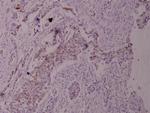 Phospho-TPL2 (Thr290) Antibody in Immunohistochemistry (Paraffin) (IHC (P))