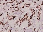 Phospho-POLR2A (Ser1619) Antibody in Immunohistochemistry (Paraffin) (IHC (P))