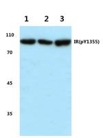 Phospho-INSR (Tyr1355) Antibody in Western Blot (WB)