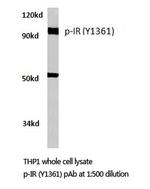 Phospho-INSR (Tyr1361) Antibody in Western Blot (WB)