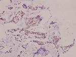 Phospho-SNAIL (Ser246) Antibody in Immunohistochemistry (Paraffin) (IHC (P))