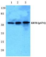 Phospho-Cytokeratin 8 (Ser74) Antibody in Western Blot (WB)